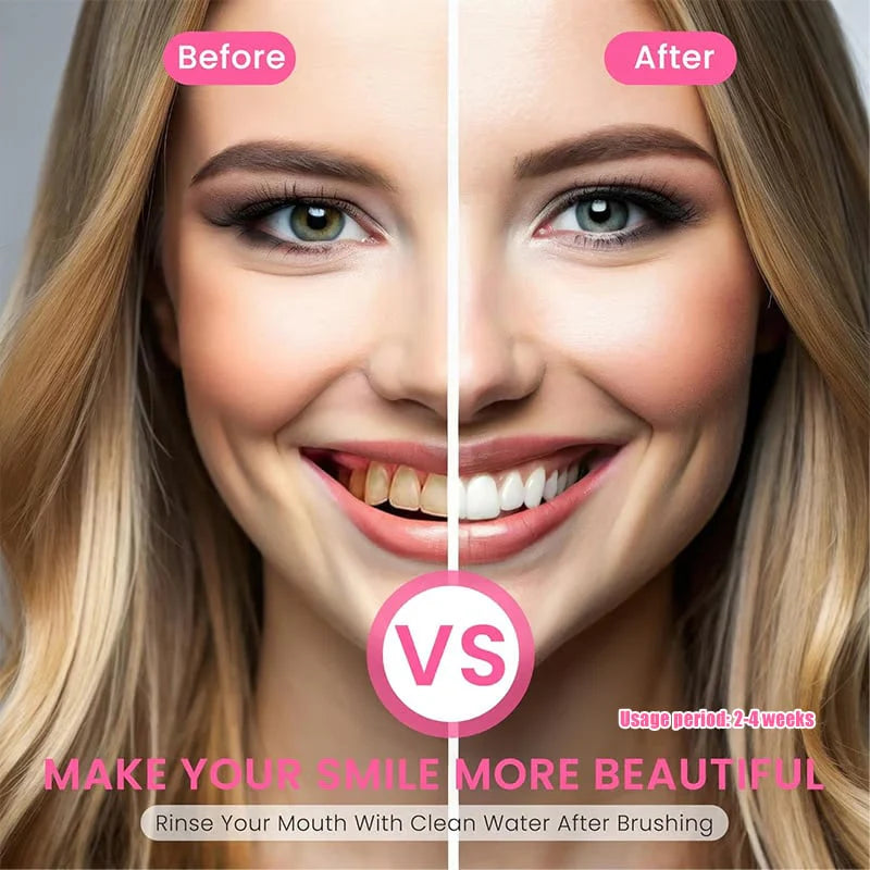 Niacinamide Whitening Toothpaste - Brighter & Healthier Teeth 🔥Buy 1 Get 1 Free🔥