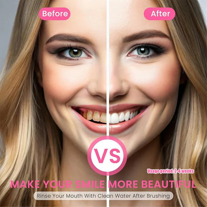 Niacinamide Whitening Toothpaste - Brighter & Healthier Teeth 🔥Buy 1 Get 1 Free🔥