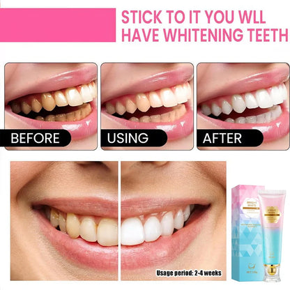 Niacinamide Whitening Toothpaste - Brighter & Healthier Teeth 🔥Buy 1 Get 1 Free🔥
